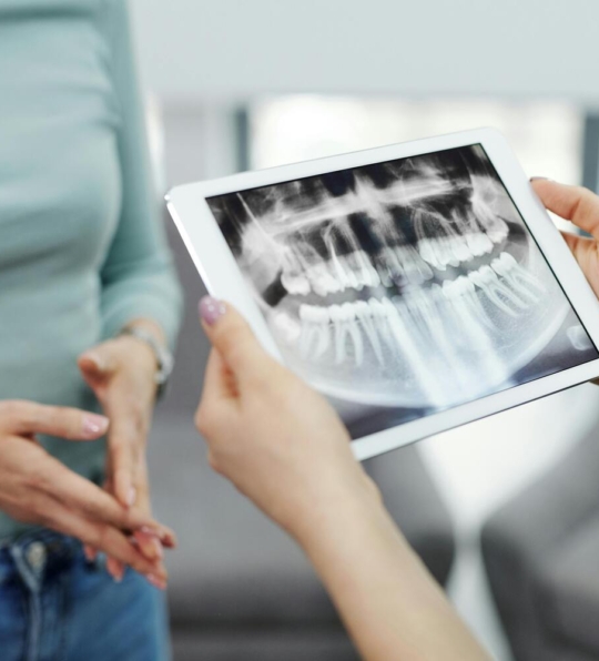 Radiografía dientes